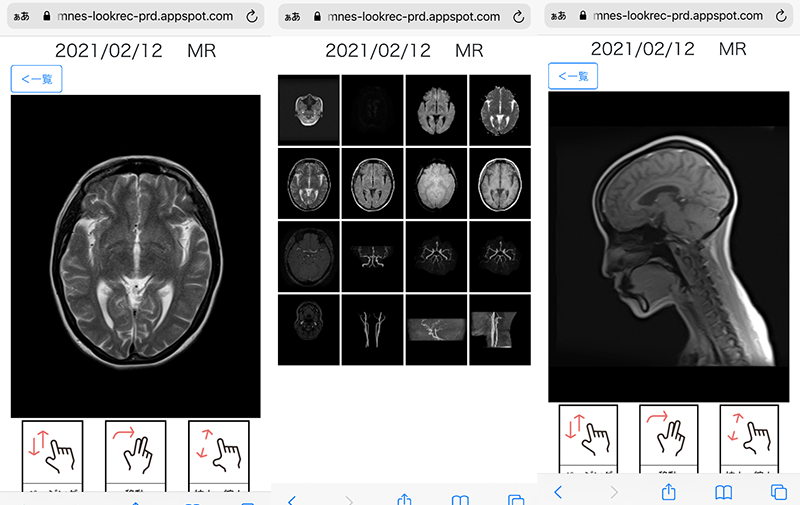 CT、MRIの結果は1週間以内にスマホから確認可能